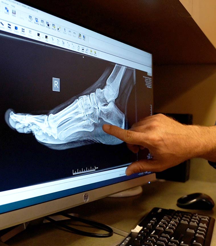 ankle foot orthopedic doctor kansas