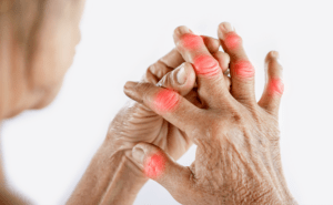 woman hand suffering from joint pain in finger