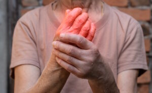 woman holding hurting arthritic hand